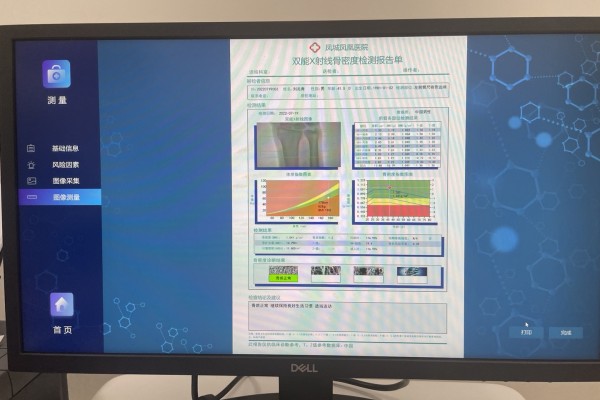 骨密度低怎么辦？養(yǎng)成良好生活習(xí)慣，從多方面增強(qiáng)骨密度